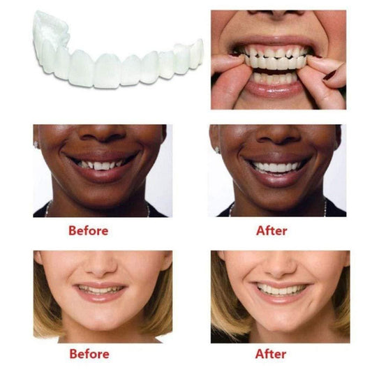 Confident on Smile Fit Flex Cosmetic Teeth